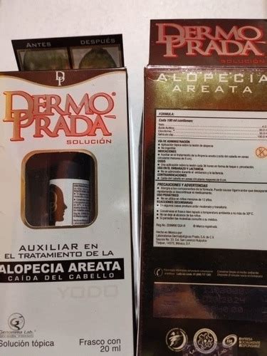 dermo prada alopesia|alopecia areata topical therapy.